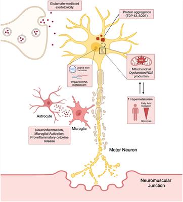 Advancements and challenges in amyotrophic lateral sclerosis